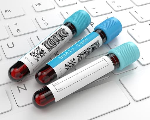 A picture of 3 HbA1c blood tubes lying on the clipboard.