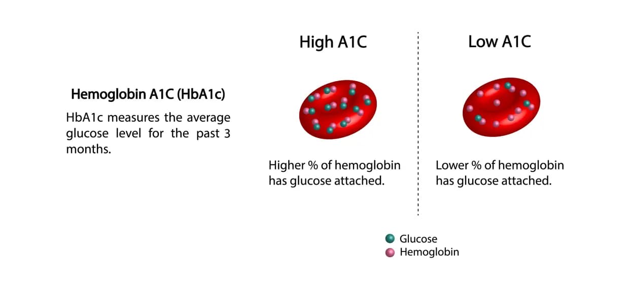 An image showing text reading: 'Hemoglobin A1C(Hb1Cc) HbA1c measures the average glucose level for the past 3 months.' And a picture of High A1C and Low A1C."